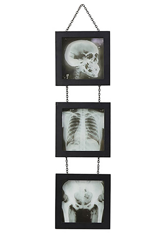 Skeleton X-Ray Wall Accent